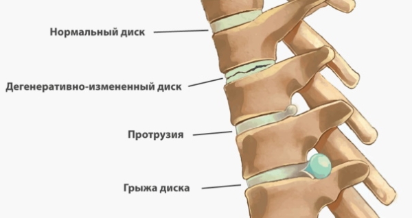 Становая тяга сумо. Техника, какие мышцы работают