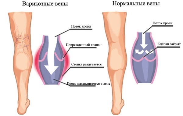 Становая тяга сумо. Техника, какие мышцы работают